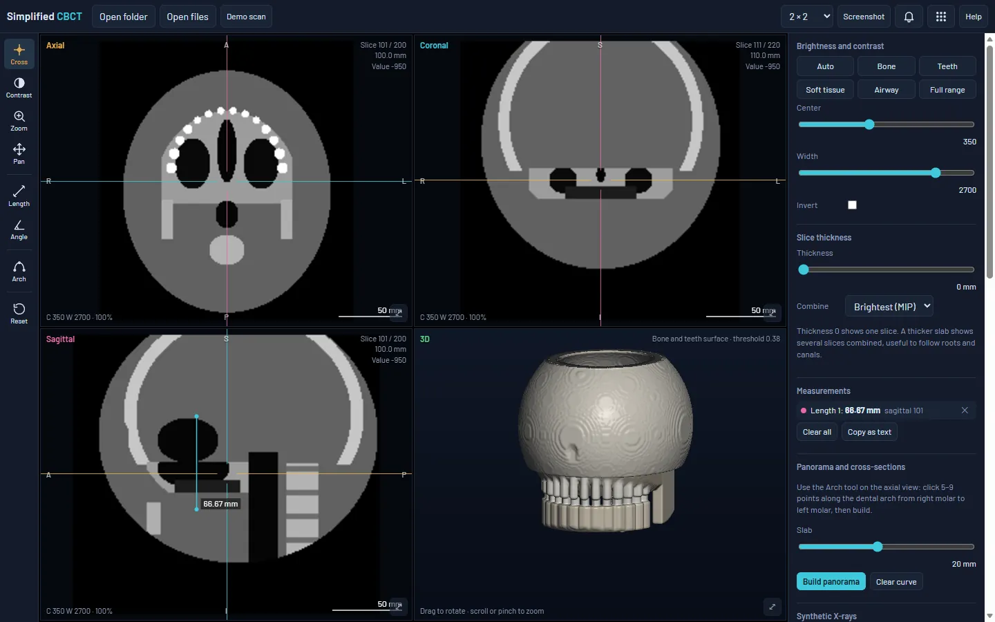 Simplified CBCT showing the demo test object in four views: axial, coronal and sagittal slices with a crosshair, a 3D surface, and the side panel with brightness presets and a length measurement.