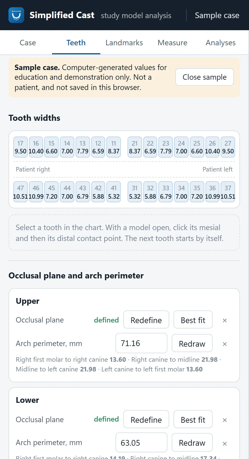The Teeth tab of Simplified Cast with the sample case: a tooth chart with the width of each tooth, and the occlusal plane and arch perimeter of each arch below it.